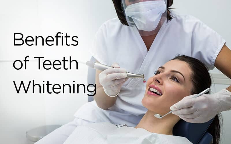 benefits of teeth whitening