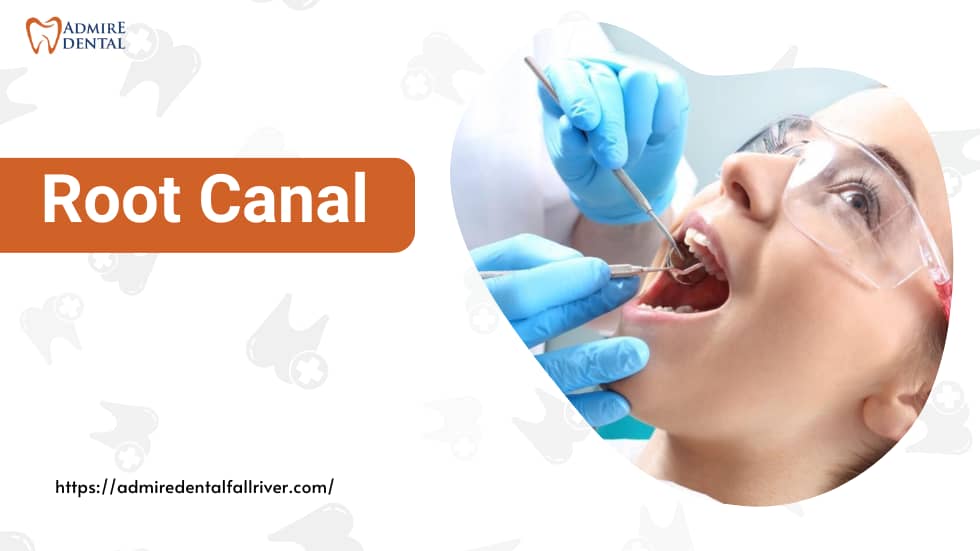 Understanding Root Canal Treatment, Procedure and Recovery