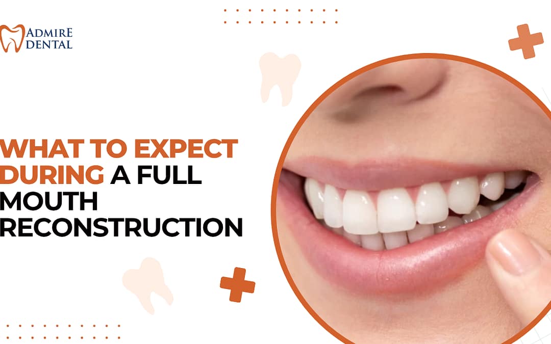 What to Expect During a Full Mouth Reconstruction