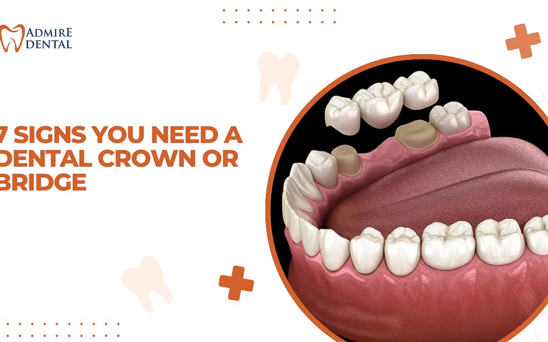 7 Signs You Need a Dental Crown or Bridge