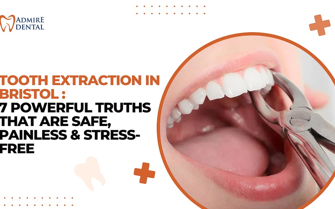 Tooth Extraction in Bristol