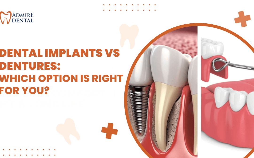 Dental Implants vs Dentures
