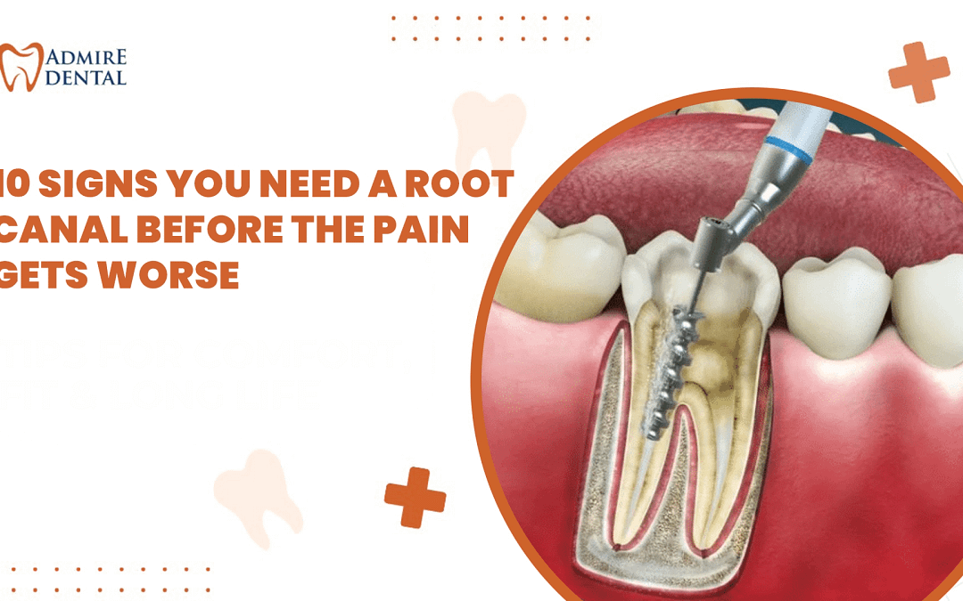 Signs You Need a Root Canal