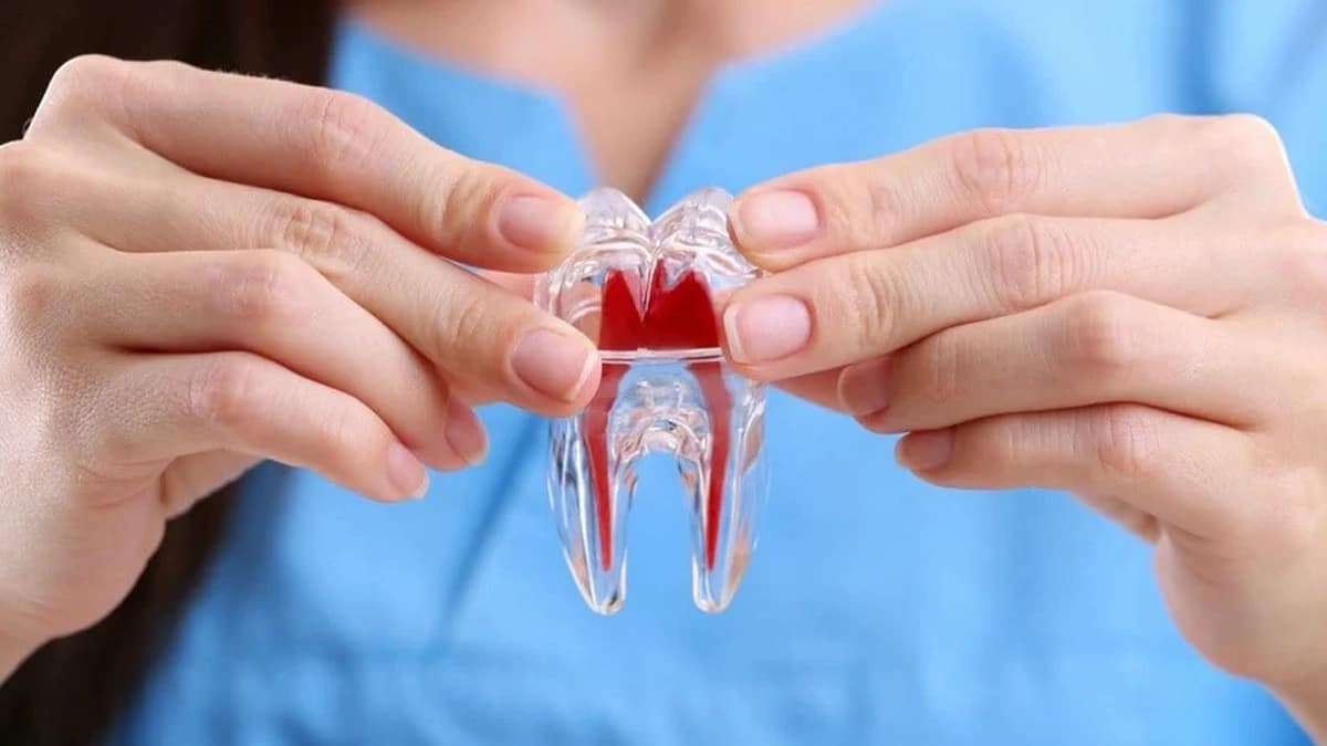What Is a Root Canal Treatment?