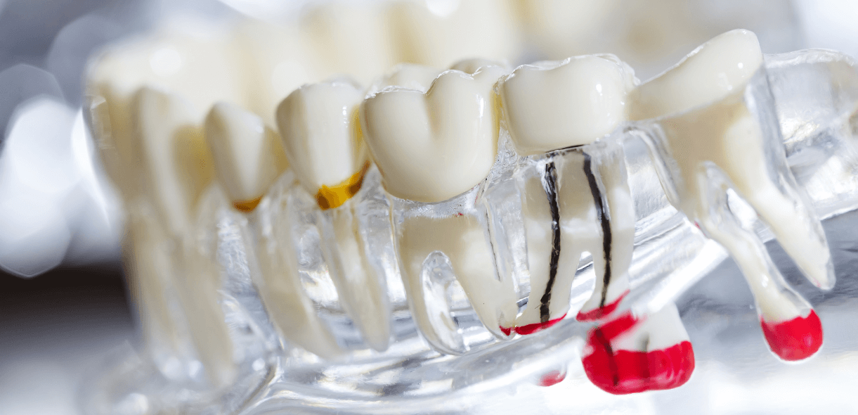 Sharp Pain While Chewing or Biting