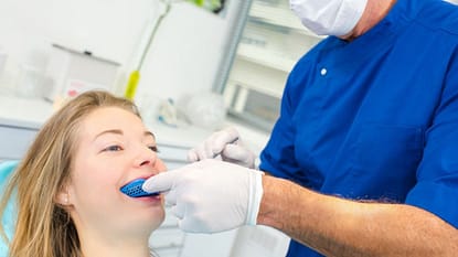 Mouth Guards for Teeth Grinders
