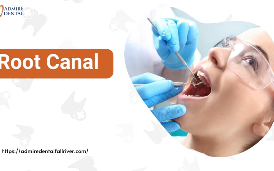 Root Canal Treatment